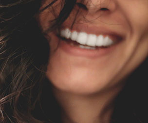 The Benefits of Teeth Whitening | Teeth Whitening | Dr Sidelsky
